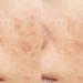 Skin Republic Glycolic Acid 10% Exfoliating Serum to visibly brighten refine tone and smooth skin texture (30ml) - Buy Online on GoSupps.com