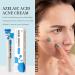 Azelaic Acid Acne Cream for Face Azelaic Acid With Hyaluronic Acids for Face Redness Smooth Anti Acne Breakouts Azelaic Acid Serum Balance Excess Oil & Soothing No Irritation - Buy Online on GoSupps.com