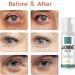 SEGMINISMART Jasmine Cream for Dark Circles Slip-On Eyelids Active Jasmine Ointment Jasmine Ointment Dark Circles 100 ml Jasmine Ointment for Dark Circles Makes Wrinkles and Dark Circles Disappear - Buy Online on GoSupps.com