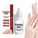 Nail Repair Liquid | Hand and Foot Repair Solution for Damaged Nails | Deep Moisturizing 15ml All Seasons For Salons Seniors Men Athletes Women and Adults