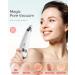 Electric Blackhead Vacuum Remover with 3 Suction Levels - USB Rechargeable & LED Screen - Facial Pore Cleanser for Men and Women - Buy Online on GoSupps.com