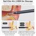 Ear Wax Removal Kit - 3.9mm Otoscope Camera for Android and iPhone - Ear Cleaning Tool with Light - Buy Online on GoSupps.com