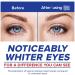 Clear Eyes Redness Relief Drops - 0.05 oz | Fast Relief for Red Eyes - Buy Online on GoSupps.com