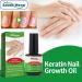 Keratin 3 Day Growth Nail Treatment Nail Strengthener for Damaged Nails Nail Growth Treatment Nail Repair Treatment Nail Strengthener and Growth Polish Nail Hardener for Thin & Brittle & Peeling Nails - Buy Online on GoSupps.com