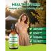 LAMGINY L-lysine 1000mg Supplement, Liposomal Lysine Liquid Drops for Adults, Essential Amino Acid - Immune Support, Skin & Lip Health, Collagen Synthesis, Vegan, Non-GMO & Gluten-Free, 4 fl oz - Buy Online on GoSupps.com