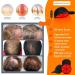 Red Light Therapy For Hair Growth|Red Light Hair Growth System|Hair Loss In Men & Women|Advanced Hair Regrowth System|Red Light Therapy Cap - Buy Online on GoSupps.com