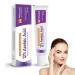 Azelaic Acid 12% Facial Serum Azelaic Acid Serum Face Cream Skin Care Beauty with Niacinamide & Vitamin C Removes Acne Redness Fade Dark Spots Correcting 20G (1)