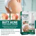 Cr me Nettoyante Acn Fesses et Cuisses Cr me pour les Boutons des Fesses Nettoyage Cr me Dissolvant de Boutons pour les Fesses 100ML 1PC - Buy Online on GoSupps.com