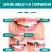 Furzero Smartsmile Mouthwash - Tooth-Rebuilding Deep Cleaning & Refreshing Breath - Total Teeth Care (1PC) | Shop Internationally - Buy Online on GoSupps.com