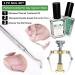 Ingrown Toenail Kit SKINAPEEL Toe Nail Softener and Ingrown Toenail Treatment Oil PLUS Ingrown Toenail Tool Correction Clamp & Double Ended Corrector Tool - Buy Online on GoSupps.com