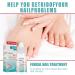 Fungal Nail Treatment | Strengthens Toenails | Toe Nail Fungus Solution - Buy Online on GoSupps.com