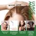 Huile de romarin pour la croissance des cheveux renforce les cheveux nourrit le cuir chevelu 2 x 60 ml - Buy Online on GoSupps.com