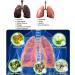 Respinature Herbal Lung Cleanse Mist - Powerful Lung Support Herbal Lung Cleansing Spray Respinature Herbal Spray Respiratory Herbal Care Essence (3PCS) - Buy Online on GoSupps.com