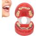 Orthodontic Demonstration Model | Professional Dental Model with Metal Wires & Brackets for Learning | International Shipping Available - Buy Online on GoSupps.com