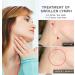 Thyroid Castor Oil Neck Wrap | Reusable Pack for Detox & Support | Comfort & Relief - Buy Online on GoSupps.com