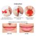 Lip Plumper Device - Silicone Lip Filler Beauty Pump for Natural Pout - City Lips Juvalips - 1 Count - Buy Online on GoSupps.com