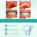 2 PCs Smile Doctor SP-4 Probiotic Whitening Toothpaste | 2024 Ultra Brightening & Fresh Breath Stain Removal - Buy Online on GoSupps.com