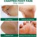 Urea Foot Cream Ultra Moisturizing 42% Urea Cream Heel Balm for Callus Removal and Soften Cracked Heel Repair Cream For Feet and Hand Maximum Strength for Hand Foot and Body Care - 100g - Buy Online on GoSupps.com