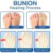 Folenzu Bunion Relief Socks - 5pcs Set for Orthoes & Projoint Antibunions - Grey Compression Toe Socks - Buy Online on GoSupps.com