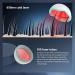 KTS Wireless Laser Therapy System for Hair Growth for Men and Women Hair Regrowth Helmet & Hat with NO Cable Hair Loss Treatment of Thinning Hair Receding Hairline & Postpartum Hair Loss - Buy Online on GoSupps.com