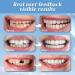 2 Pairs Temporary Smile Support Adjustable for All Genders Nature and Comfortable Regain Confidence Smile(White) - Buy Online on GoSupps.com