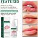 Mouth Ulcer Treatment Spray Mouth Ulcer Spray Canker Sore Treatment for Adults Oralcare Propolis Ulcer Relief Spray Herbal Mouth Spray Canker Relief Spray Breath Spray for Bad Breath Breath Freshener - Buy Online on GoSupps.com