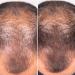 Freshly Cosmetics Anti-Hair Loss and Healthy Strong Growth Hair Growth & Density Treatment 50ml - Buy Online on GoSupps.com