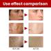 JOYVOIDX Facial Care Cream with Niacinamide Glabridin and Aloe Extract Moisturizing and Even Tone Formula for Dull Skin and Dark Spot Care Nourishing Daily Moisturizer 20g - Buy Online on GoSupps.com