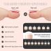 LIARTY Full Cover French Toenails Kit - 280 Natural Toe Nails with Adhesive Tabs & Accessories - Buy Online on GoSupps.com