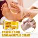 Anti-Dry Skin Foot Cream | Nourishing Moisturizer for Dry Feet - A Size | International Shipping Available - Buy Online on GoSupps.com