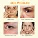 Vitamin C Eye Cream - Reduce Dark Circles Puffiness & Fine Lines | Anti-Aging Under Eye Cream (0.7 FL.Oz - Buy Online on GoSupps.com