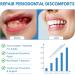 Periodontal Disease Treatment -1.7% Hydrogen Peroxide Gel for Bleeding Gums Gum Repair Bad Breath - 3.52 Ounce Tube - Buy Online on GoSupps.com