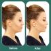 Double Chin Reducer ihohi Facial Cheek V Line Lifting Up Bandage Patch Facial Slimming Strap Reusable Facial Shaped UP Lift Belt for Women Tightening Skin Preventing Sagging - Buy Online on GoSupps.com