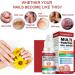 EUBEISAQI Multifunctional nail repair Nail renewal Nighttime Nail 10ml Fungi Fingernail & Toe Nail Solution for broken cracked and discolored nails or fingernails - Buy Online on GoSupps.com