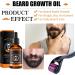 Beard Growth Kit with Derma Roller & Beard Oil Serum for Men | Grooming & Hair Growth | Rapid Grow & Thickening | Type1 - Buy Online on GoSupps.com