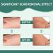 Medical Grade Silicone Scar Sheets (1.57 x 60) - Effective Scar Removal Strips for Acne & Burn Scars - Buy Online on GoSupps.com
