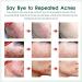 Anti Acne Face Cream Tea Tree Acne Cream for Acne Treatment & Spot Treatment Spot Cream Soothing Ance Gel for Blemishes Blackhead Remover Acne Moisturiser Reduces Redness Oil Control - Buy Online on GoSupps.com