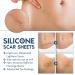 Silicone Scar Treatment Roll Professional Solution for C-Section Burns Keloids & Acne | 4cm x 290cm | Free Shipping - Buy Online on GoSupps.com
