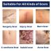 Advanced Scar Gel - Powerful Cream for Surgical, Burn, and Acne Scars - 30g - Buy Online on GoSupps.com