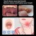 Black Tonsil Stone Removal Kit & Vacuum - Manual Tool for Adults - Buy Online on GoSupps.com