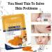 Turmeric Face Ma-sk | 10 Moisturizing Turmeric Ma-sk | Facial Ma-sk With Turmeric Extract | Turmeric Face Skin Care Patchfor Brightening Skin Tone/hydrating/relieving Dullness - Buy Online on GoSupps.com