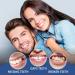 VRYNDH Cosmetic dental facets 2 pairs teeth whitening temporary dental prosthesis safe and comfortable instant smile with heatadhesive beads for temporary repair of dental problems - Buy Online on GoSupps.com
