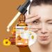 Natural Honey Eye Drops | Stingless Bee Honey for Eye Care (2pcs) - Shop Internationally - Buy Online on GoSupps.com