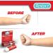 Restorz Hydrocortisone 1% Cream Stick (2 Pack) - Fast-Acting Relief for Itches, Bites, Redness & Rashes - Buy Online on GoSupps.com