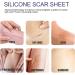 Silicone Scar Tape Roll - Professional Reusable Sheets for Surgical Caesarean Scar Removal - Buy Online on GoSupps.com