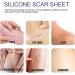 Silicone Scar Sheets - Surgical and Caesarean Scar Removal Tape for Men and Women - Buy Online on GoSupps.com