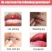 Pink Fresh Lip Lightening Balm - Fast Dark Lip Treatment Hydrate & Restore for Smokers (4pc - Buy Online on GoSupps.com
