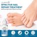 Extra Strength Nail Repair Drop for Toenail Fungus Treatment - Restores Appearance of Discolored Nails - Natural Herbal Extract - 1 Count - Buy Online on GoSupps.com