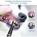 Ankilo Newest Dog Teeth Cleaning Kit USB Charging Pet Ultrasonic Tooth Cleaner 5 Modes Dog Tooth Tartar Remover Automatic Identification of Gums Ipx6 Waterproof Dog Teeth Cleaning for Pets - Buy Online on GoSupps.com
