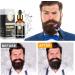 Dessnill Men's Beard Care Set - 0.5mm Dermaroller & Growth Serum Oil for Faster Beard & Hair Growth | International Shipping - Buy Online on GoSupps.com